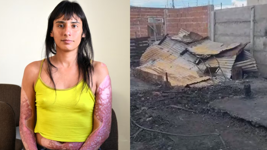 Su expareja incendió la casa donde ella y sus hijos dormían pero lograron sobrevivir