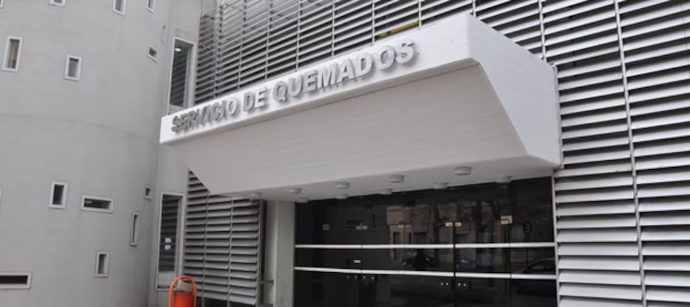 “Está todo quemado, no me dejó nada”: le dieron el alta a la mujer que fue rociada con ácido por su ex