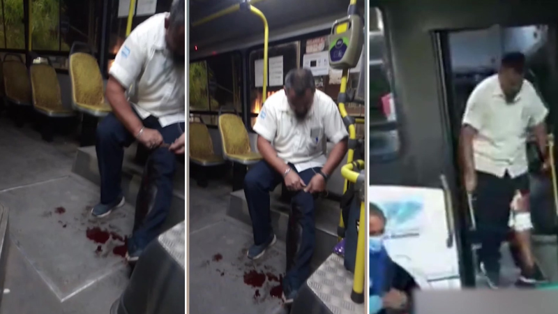Así el colectivero baleado en Maquinista Savio se hizo el torniquete y frenó la hemorraia en Escobar