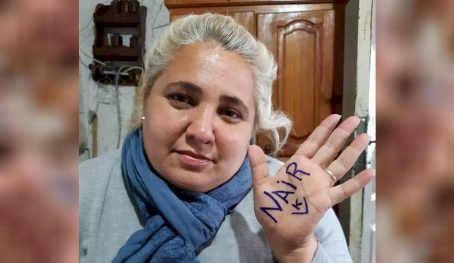 Falleció la concejala de Quilmes que sufrió graves quemaduras tras una pelea de pareja